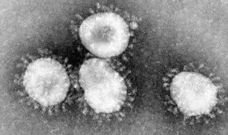 Coronaviruses are a group of viruses that have a halo, or crown-like (corona) appearance when viewed under an electron microscope (Credit: CDC/Doctor Fred Murphy PD-USGov-HHS-CDC)